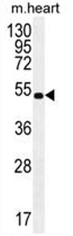 BRUNOL6 Antibody (N-term) western blot analysis in mouse heart tissue lysates (35ug/lane).This demonstrates the BRUNOL6 antibody detected the BRUNOL6 protein (arrow).