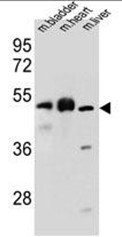 BTBD17 Antibody (C-term) western blot analysis in mouse bladder, heart, liver tissue lysates (35ug/lane).This demonstrates the BTBD17 antibody detected the BTBD17 protein (arrow).