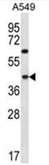 C109B Antibody (C-term) western blot analysis in A549 cell line lysates (35ug/lane).This demonstrates the C109B antibody detected the C109B protein (arrow).