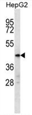 C10orf129 Antibody (C-term) western blot analysis in HepG2 cell line lysates (35ug/lane).This demonstrates the C10orf129 antibody detected the C10orf129 protein (arrow). C10orf129 Antibody (C-term) western blot analysis in HepG2 cell line lysates (35ug/lane).This demonstrates the C10orf129 antibody detected the C10orf129 protein (arrow).