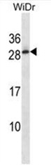 C11orf20 Antibody (C-term) western blot analysis in WiDr cell line lysates (35ug/lane).This demonstrates the C11orf20 antibody detected the C11orf20 protein (arrow).
