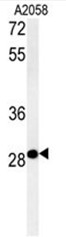 C11orf46 Antibody (C-term) western blot analysis in A2058 cell line lysates (35ug/lane).This demonstrates the C11orf46 antibody detected the C11orf46 protein (arrow).