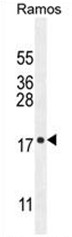 C11orf53 Antibody (C-term) western blot analysis in Ramos cell line lysates (35ug/lane).This demonstrates the C11orf53 antibody detected the C11orf53 protein (arrow).