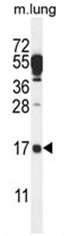C14orf126 Antibody (C-term) western blot analysis in mouse lung tissue lysates (35ug/lane).This demonstrates the C14orf126 antibody detected the C14orf126 protein (arrow). C14orf126 Antibody (C-term) western blot analysis in mouse lung tissue lysates (35ug/lane).This demonstrates the C14orf126 antibody detected the C14orf126 protein (arrow).