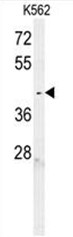 C6orf58 Antibody (Center) western blot analysis in K562 cell line lysates (35ug/lane).This demonstrates the C6orf58 antibody detected the C6orf58 protein (arrow).