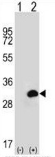 Western blot analysis of KITLG Antibody (C-term) (Cat.#TA302195) in 293 cell line lysates (35ug/lane). KITLG (arrow) was detected using the purified Pab.