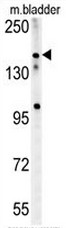 Western blot analysis of CDH1 Antibody (C-term) (Cat.#TA302228) in A375 cell line lysates (35ug/lane). CDH1 (arrow) was detected using the purified Pab.
