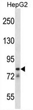CATSPER1 Antibody (N-term) western blot analysis in HepG2 cell line lysates (35ug/lane).This demonstrates the CATSPER1 antibody detected the CATSPER1 protein (arrow).