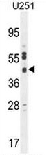 CB018 Antibody (C-term) western blot analysis in U251 cell line lysates (35ug/lane).This demonstrates the CB018 antibody detected the CB018 protein (arrow).