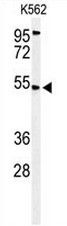Western blot analysis of CBAA1 Antibody (N-term) in K562 cell line lysates (35ug/lane). CBAA1 (arrow) was detected using the purified Pab.