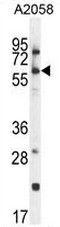 CCDC148 Antibody (Center) western blot analysis in A2058 cell line lysates (35ug/lane).This demonstrates the CCDC148 antibody detected the CCDC148 protein (arrow).
