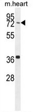 CCDC38 Antibody (Center) western blot analysis in mouse heart tissue lysates (35ug/lane).This demonstrates the CCDC38 antibody detected the CCDC38 protein (arrow).