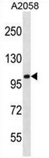 CCDC46 Antibody (N-term) western blot analysis in A2058 cell line lysates (35ug/lane).This demonstrates the CCDC46 antibody detected the CCDC46 protein (arrow).