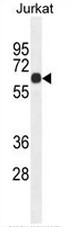 CCDC8 Antibody (C-term) western blot analysis in Jurkat cell line lysates (35ug/lane).This demonstrates the CCDC8 antibody detected the CCDC8 protein (arrow).