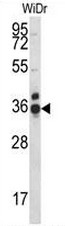 CCDC90B Antibody (Center) western blot analysis in WiDr cell line lysates (35ug/lane).This demonstrates the CCDC90B antibody detected the CCDC90B protein (arrow).