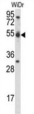 CCNI Antibody (C-term) western blot analysis in WiDr cell line lysates (35ug/lane).This demonstrates the CCNI antibody detected the CCNI protein (arrow).