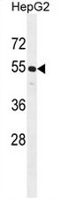 CCNJL Antibody (Center) western blot analysis in HepG2 cell line lysates (35ug/lane).This demonstrates the CCNJL antibody detected the CCNJL protein (arrow).