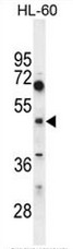 CEPT1 Antibody (N-term) western blot analysis in HL60 cell line lysates (35ug/lane).This demonstrates the CEPT1 antibody detected the CEPT1 protein (arrow).