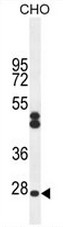 TA302474 staining (1ug/ml) of Jurkat lysate (RIPA buffer, 35ug total protein per lane). Primary incubated for 1 hour. Detected by western blot using chemiluminescence.