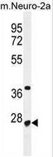CF153 Antibody (C-term) western blot analysis in mouse Neuro-2a cell line lysates (35ug/lane).This demonstrates the CF153 antibody detected the CF153 protein (arrow).