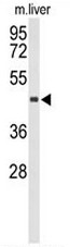 TA302492 (1ug/ml) staining of Human Bone Marrow lysate (35ug protein in RIPA buffer). Primary incubation was 1 hour. Detected by chemiluminescence.