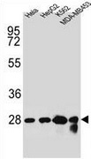 Western blot analysis in Hela, HepG2, K562, MDA-MB453 cell line lysates (35ug/lane) using Cholinephosphotransferase 1 antibody. (N-term). This demonstrates the CHPT1 antibody detected the CHPT1 protein (arrow).