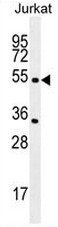 TA302501 staining (0.5ug/ml) of Jurkat lysate (RIPA buffer, 30ug total protein per lane). Primary incubated for 1 hour. Detected by western blot using chemiluminescence.