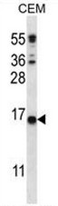 CJ057 Antibody (C-term) western blot analysis in CEM cell line lysates (35ug/lane).This demonstrates the CJ057 antibody detected the CJ057 protein (arrow).