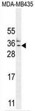 CK073 Antibody (N-term) western blot analysis in MDA-MB435 cell line lysates (35ug/lane).This demonstrates the CK073 antibody detected the CK073 protein (arrow).