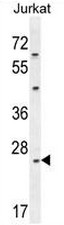 CLDN22 Antibody (Center) western blot analysis in Jurkat cell line lysates (35ug/lane).This demonstrates the CLDN22 antibody detected the CLDN22 protein (arrow).