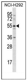Western blot analysis in NCI-H292 cell line lysates (35ug/lane) using CLEC18A Antibody (C-term). This demonstrates the CLEC18A antibody detected the CLEC18A protein (arrow).