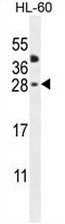 CLEC2A Antibody (Center) western blot analysis in HL-60 cell line lysates (35ug/lane).This demonstrates the CLEC2A antibody detected the CLEC2A protein (arrow).