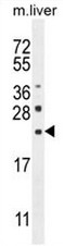 CLEC2L Antibody (N-term) western blot analysis in mouse liver tissue lysates (35ug/lane).This demonstrates the CLEC2L antibody detected the CLEC2L protein (arrow).