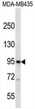 CNGB3 Antibody (N-term) western blot analysis in MDA-MB435 cell line lysates (35ug/lane).This demonstrates the CNGB3 antibody detected the CNGB3 protein (arrow).