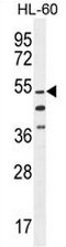TA302582 (1ug/ml) staining of HeLa cell lysate (35ug protein in RIPA buffer) with (B) and without (A) blocking with the immunising peptide. Primary incubation was 1 hour. Detected by chemiluminescence.