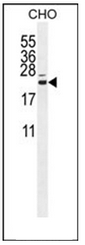 Western blot analysis of CP013 Antibody (N-term) in CHO cell line lysates (35ug/lane).This demonstrates the CP013 antibody detected the CP013 protein (arrow).