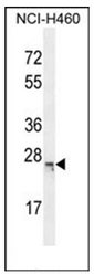Western blot analysis of C16orf45 Antibody (Center) in NCI-H460 cell line lysates (35ug/lane).This demonstrates the CP045 antibody detected the CP045 protein (arrow).
