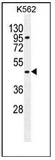 Western blot analysis of Carboxypeptidase A3 Antibody in K562 cell line lysates (35ug/lane). This demonstrates the CPA3 antibody detected the CPA3 protein (arrow).