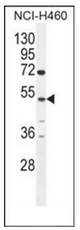 TA302616 staining (1.5ug/ml) of Jurkat lysate (RIPA buffer, 35ug total protein per lane). Primary incubated for 1 hour. Detected by western blot using chemiluminescence.