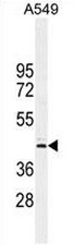 CT112 Antibody (Center) western blot analysis in A549 cell line lysates (35ug/lane).This demonstrates the CT112 antibody detected the CT112 protein (arrow).