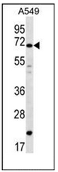 Western blot analysis of DAZ4 Antibody in A549 cell line lysates (35ug/lane). This demonstrates the DAZ4 antibody detected the DAZ4 protein (arrow).