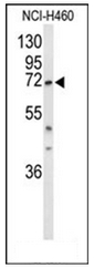 TA302729 staining (4ug/ml) of A431 lysate (RIPA buffer, 35ug total protein per lane). Primary incubated for 12 hour. Detected by western blot using chemiluminescence.