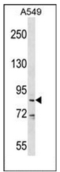 Western blot analysis of DDX53 Antibody (C-term) in A549 cell line lysates (35ug/lane). This demonstrates the DDX53 antibody detected the DDX53 protein (arrow).