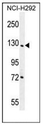 Western blot analysis of DDX60L Antibody (C-term) in NCI-H292 cell line lysates (35ug/lane). This demonstrates the DDX60L antibody detected the DDX60L protein (arrow).