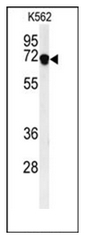 Western blot analysis of DENND1A Antibody (C-term) in K562 cell line lysates (35ug/lane). DEN1A (arrow) was detected using the purified Pab.