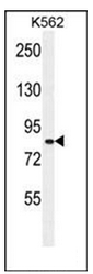 Western blot analysis of Whirlin Antibody in K562 cell line lysates (35ug/lane).
