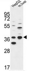 TA302760 staining (2ug/ml) of Human Brain lysate (RIPA buffer, 30ug total protein per lane). Primary incubated for 12 hour. Detected by western blot using chemiluminescence.