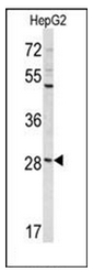 Western blot analysis of DIPA Antibody in HepG2 cell line lysates (35ug/lane). DIPA (arrow) was detected using the purified Pab.