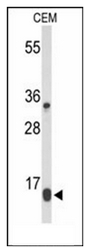Western blot analysis of DIRAS1 Antibody in CEM cell line lysates (35ug/lane). DIRAS1 (arrow) was detected using the purified Pab.