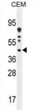 Western blot analysis in CEM cell line lysates (35ug/lane) using DNAJC22 antibody. (C-term). This demonstrates this antibody detected the DNAJC22 protein (arrow).
